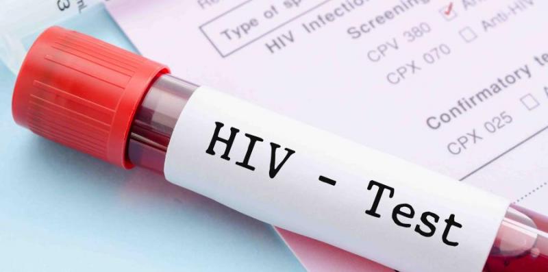Prueba Test VIH